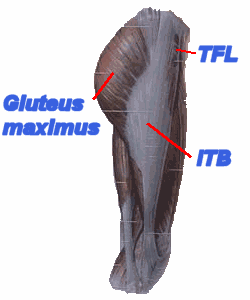 Picture of Gluteus maximus and Iliotibial band