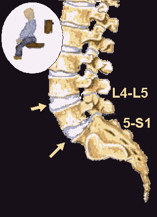 L5 Spine