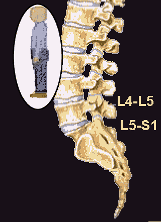 The Standing Lumbar Spine