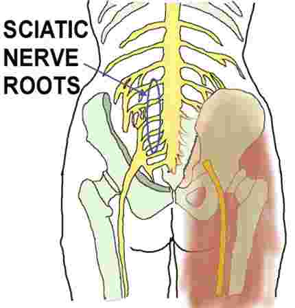Cauda equina and Siatic nerve