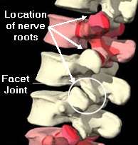 Facet joints and location of lumbar nerve roots