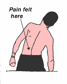lower back diagram