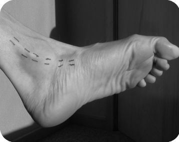 How Tibialis Posterior Works: Contraction