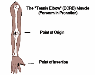 Tennis elbow cures - requires you understand your ECRB muscle