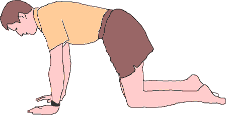 Diagram: Marked Pain when flexing in Quadriped 
Position = Lumbar Flexion Syndrome