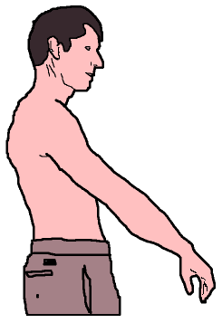 Picture of Scapular Winging